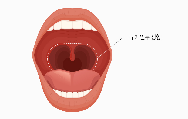 이미지 추가 중