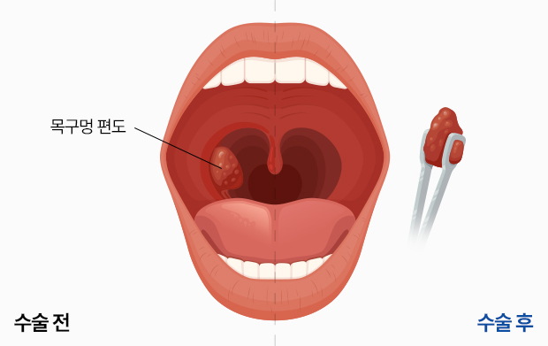 이미지 추가 중