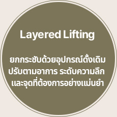 Layered Lifting