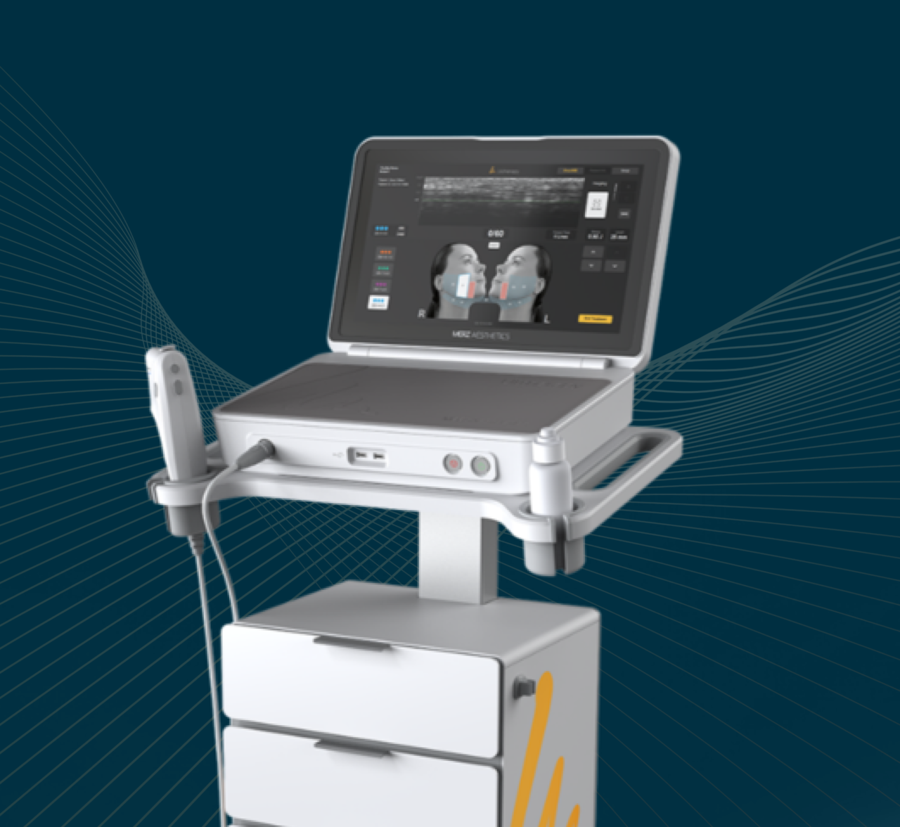 울쎄라피 프라임 - 부산 실리프팅