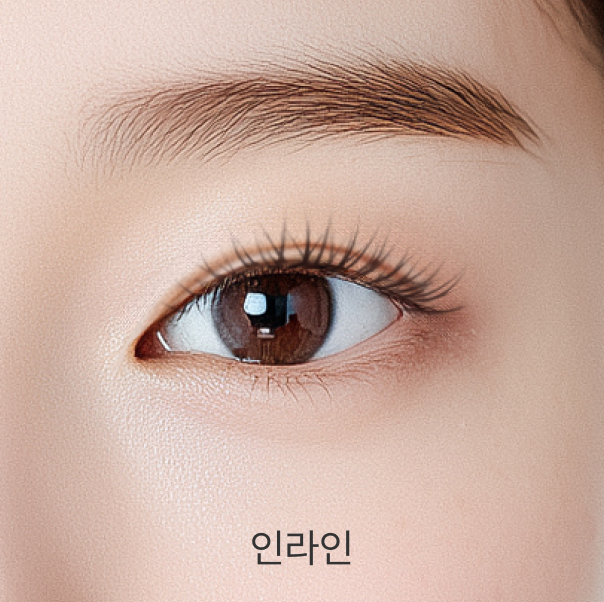 인라인 - 리프트리성형외과 쌍꺼풀 형태 설명 이미지