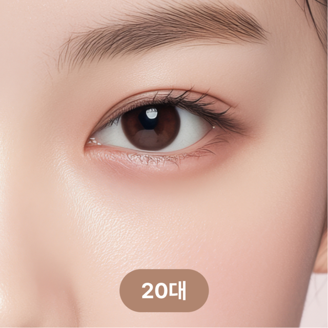 <p style="margin-top:40px; line-height:1.5;"><span style="color: rgb(102, 102, 102); font-size: 20px;">안와지방이 튀어나와 볼록한 눈밑</span></p>