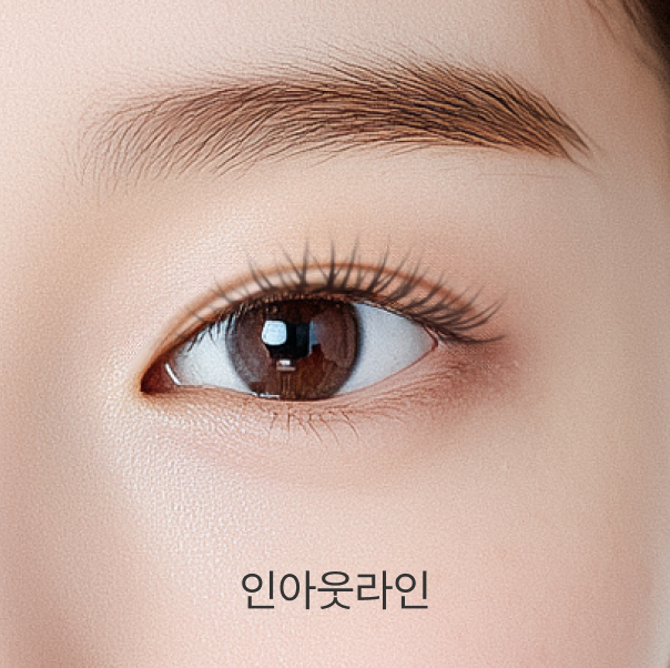 인아웃라인 - 리프트리성형외과 쌍꺼풀 형태 설명 이미지