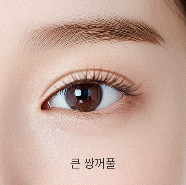 큰 쌍꺼풀 - 리프트리성형외과 쌍꺼풀 높이 설명 이미지