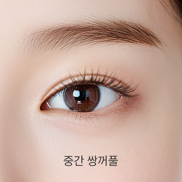 중간 쌍꺼풀 - 리프트리성형외과 쌍꺼풀 높이 설명 이미지