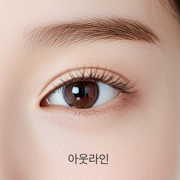 아웃라인 - 리프트리성형외과 쌍꺼풀 형태 설명 이미지
