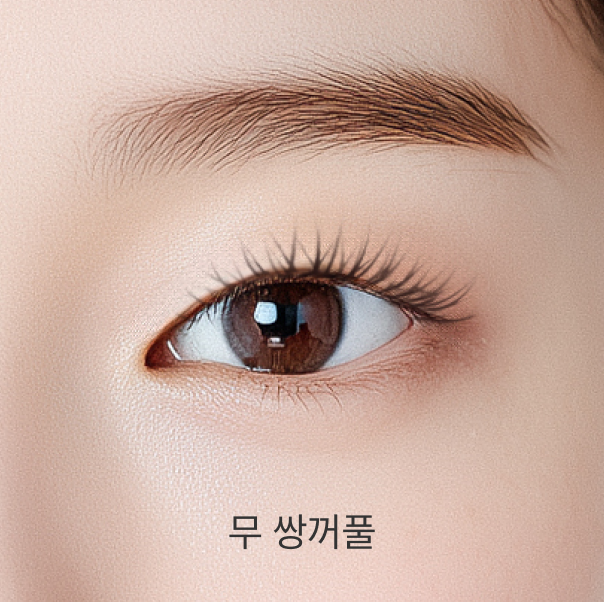 무 쌍꺼풀 - 리프트리성형외과 쌍꺼풀 높이 설명 이미지
