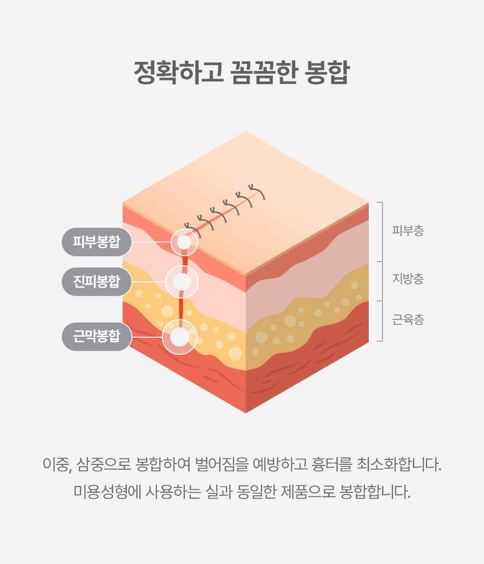 리드성형외과-열상-화상-찢어진상처