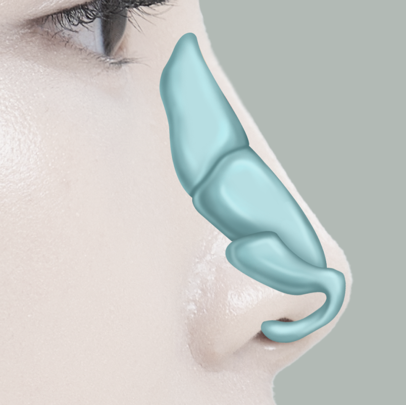 <p style="margin-top:20px;"><span style="font-size: 30px;"><strong><span style="color: rgb(255, 255, 255);">비중격연골</span></strong></span></p>