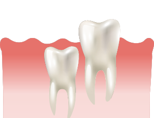 사랑니가 겉으로 잘 보이지 않는 경우