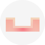 박스카 흉터에 대한 설명