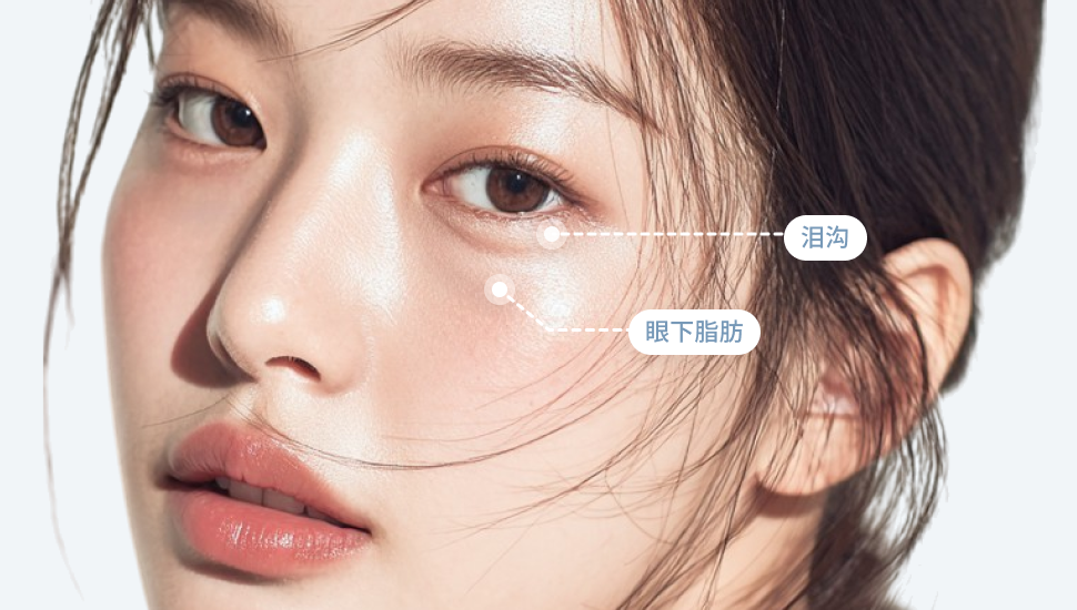 IS-under-eye-fat-img