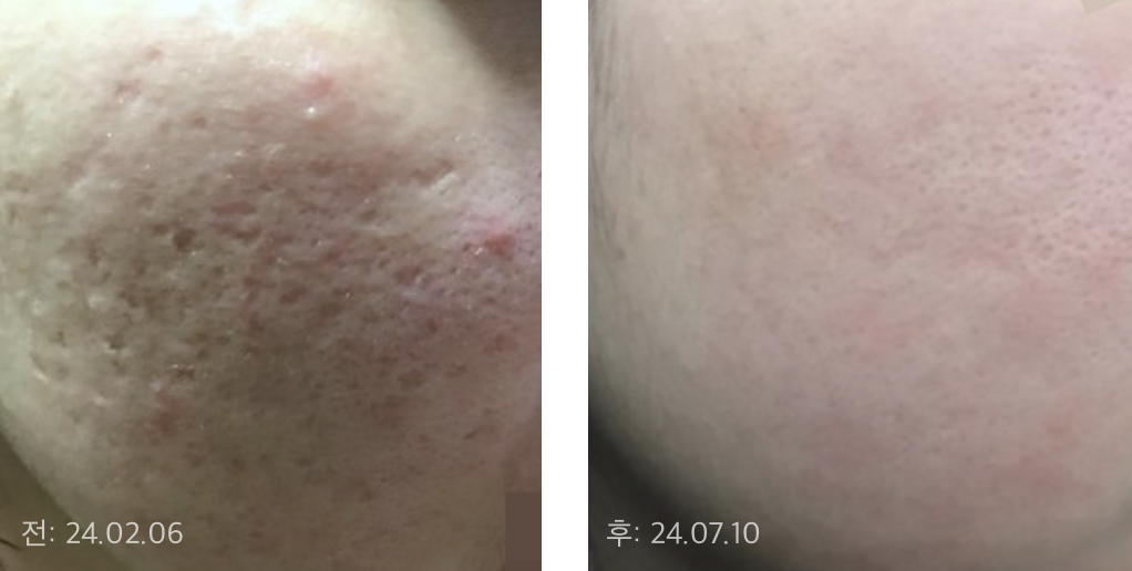 ※ 동일 조건으로 촬영되었으며, 별도의 조작·보정이 없는 전후 사진입니다.