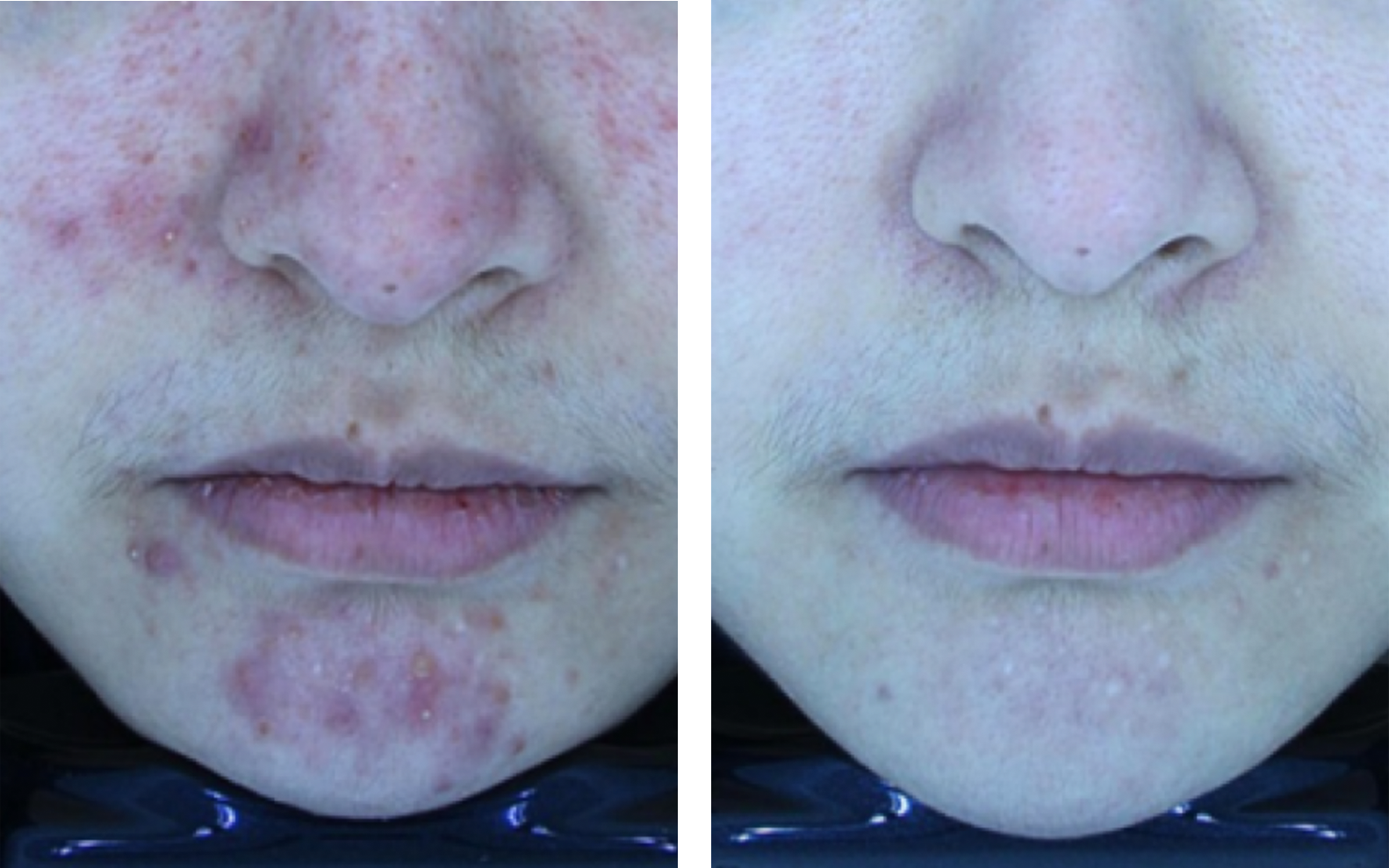 전 22.06.13 / 후 22.10.18