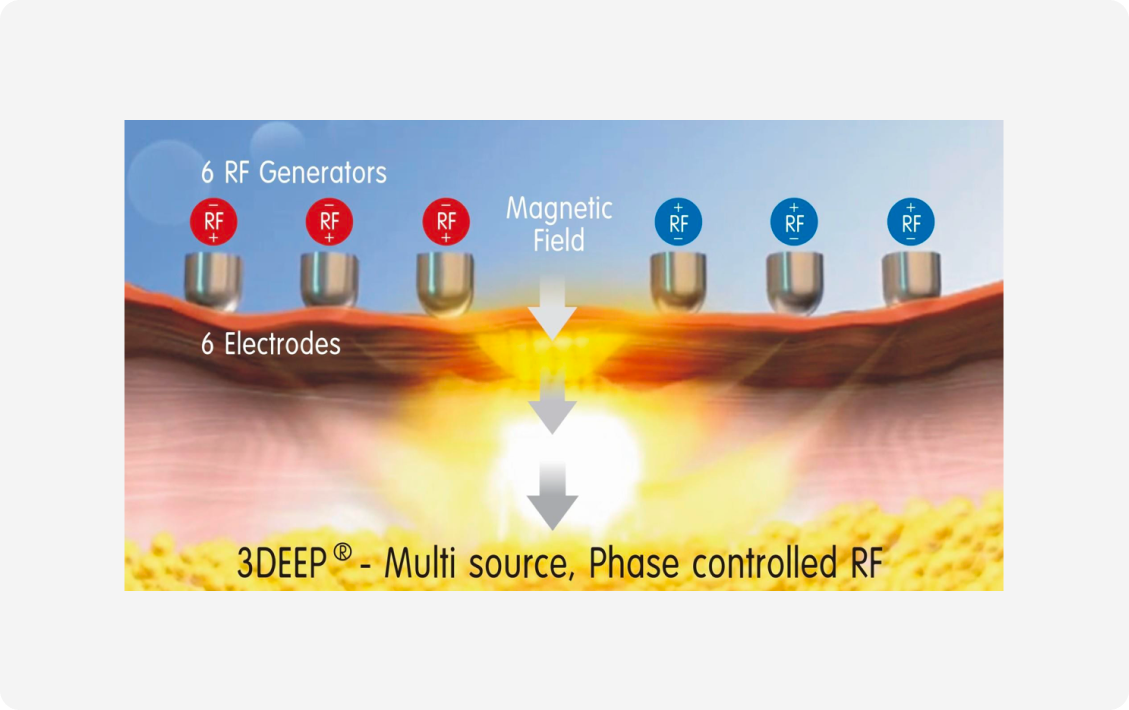 텐쎄라의 강력한 효과, 개념 설명