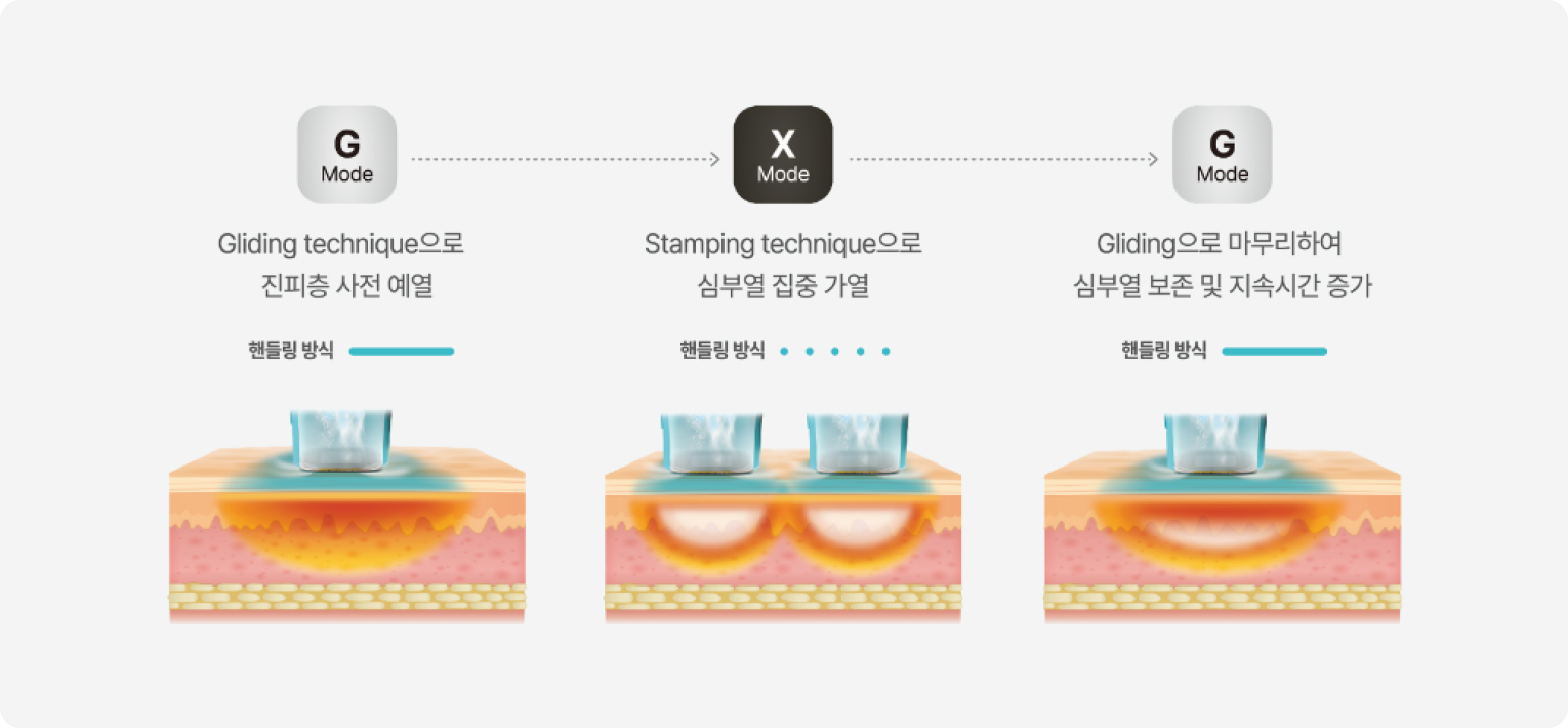 올리지오 X 원리 설명