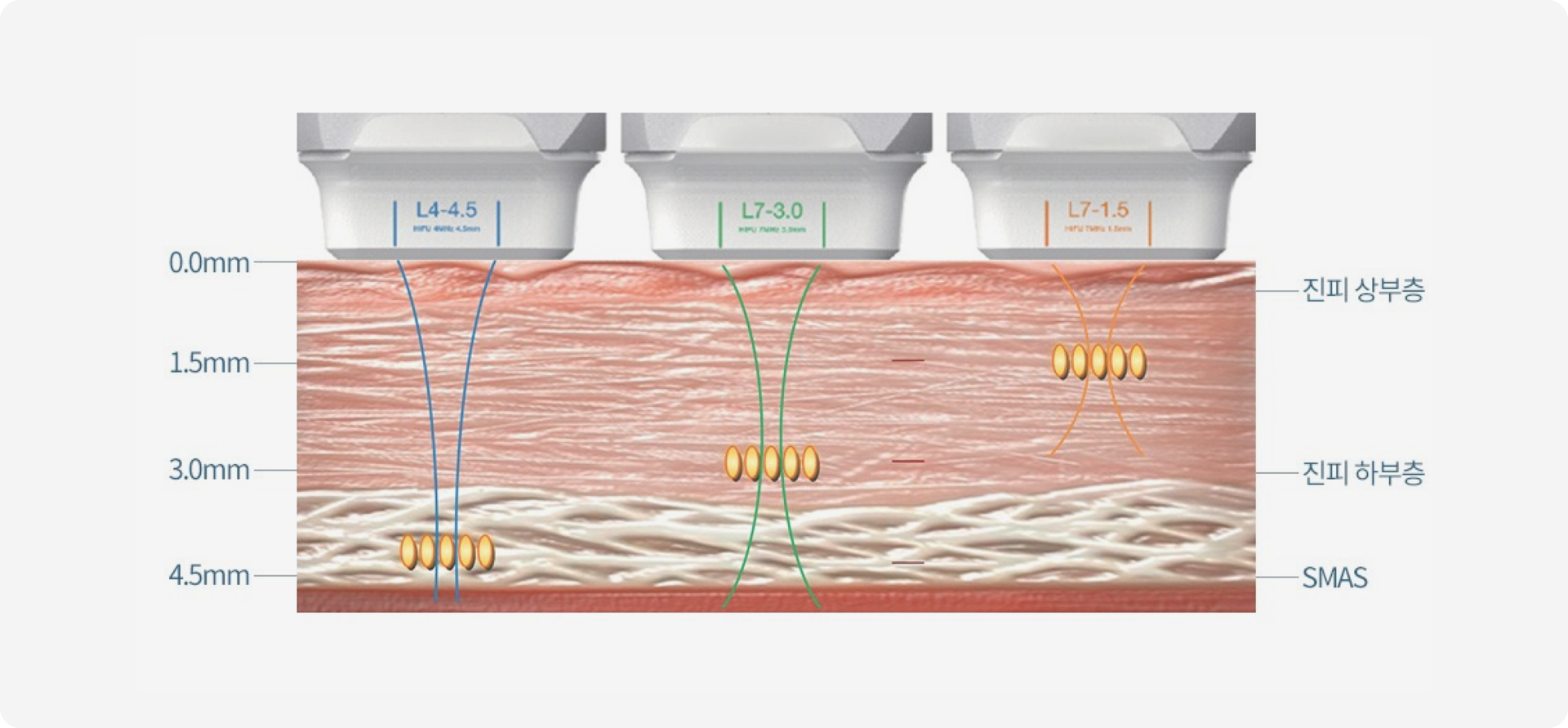 슈링크 원리 설명