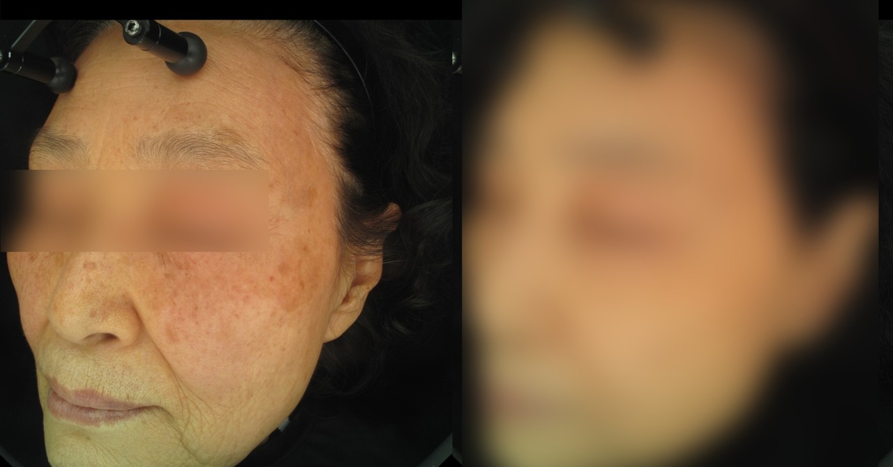 전후사진 보러 가기