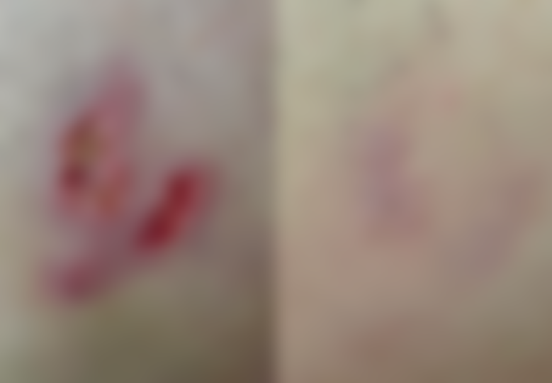 전 후 사진 보러 가기