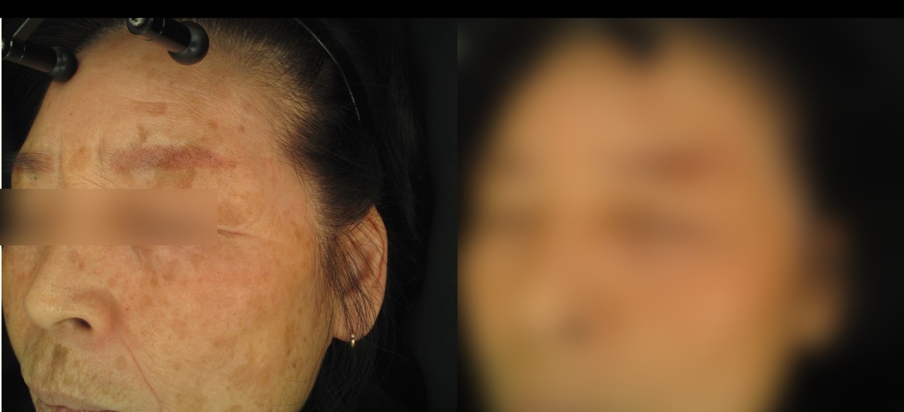 전후사진 보러 가기