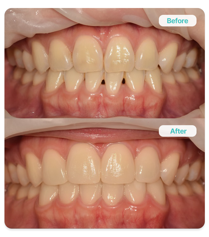 <p><span style="font-size: 26px;"><span style="color: rgb(63, 193, 190);"><strong>01 </strong></span><span style="color: rgb(151, 151, 151);"><strong>동안 비앙쉬 (38세)</strong></span></span></p>