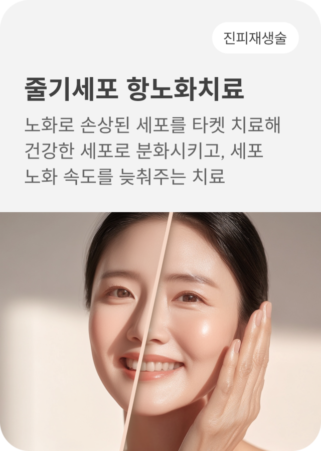청담 끌레어의원 줄기세포 항노화치료 시술 이미지