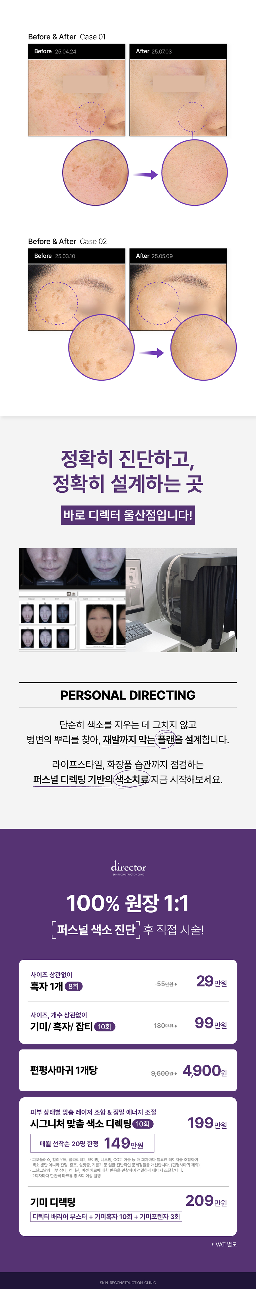 울산 피부과 레이저 복합치료로 기미 잡티 점 제거 