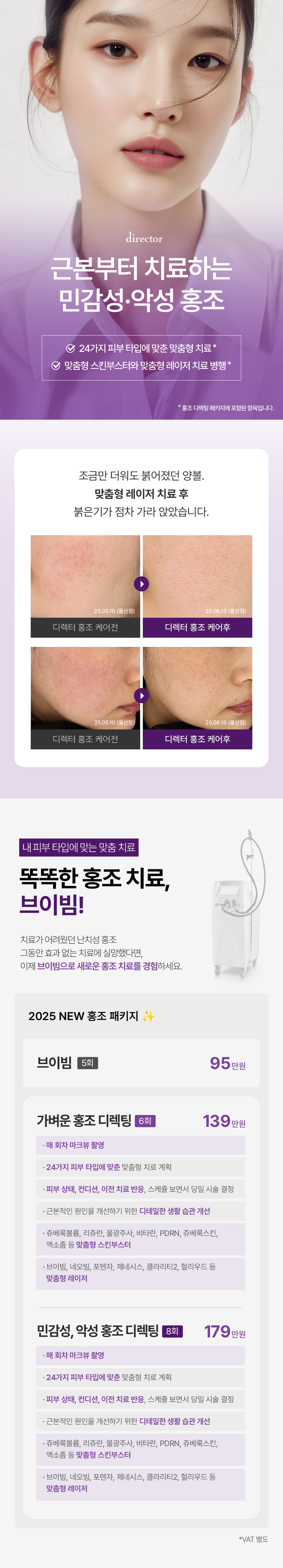 똑똑한 홍조 치료, 브이빔, 맞춤형 스킨부스터와 레이저