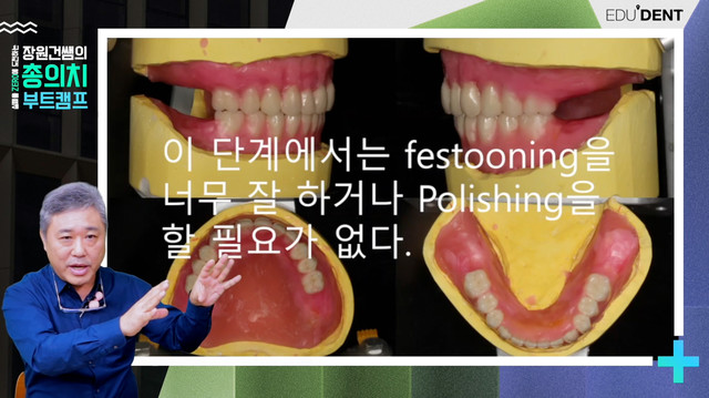 기공소와의 소통까지 포함한 전 과정 가이드