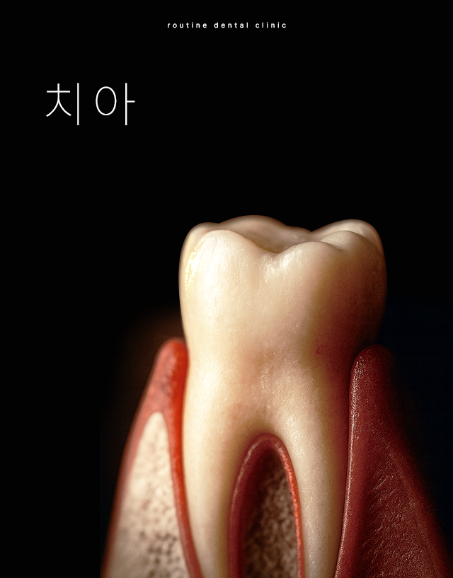 인천송도치과 루틴치과 치아 보존치료