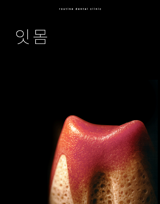 인천송도치과 루틴치과 잇몸치료