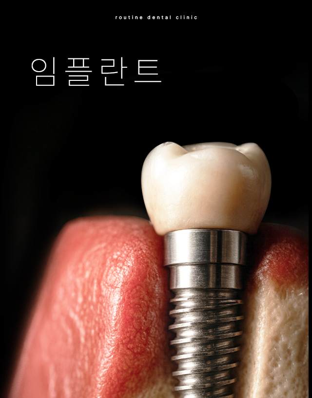 인천송도치과 루틴치과 임플란트치료