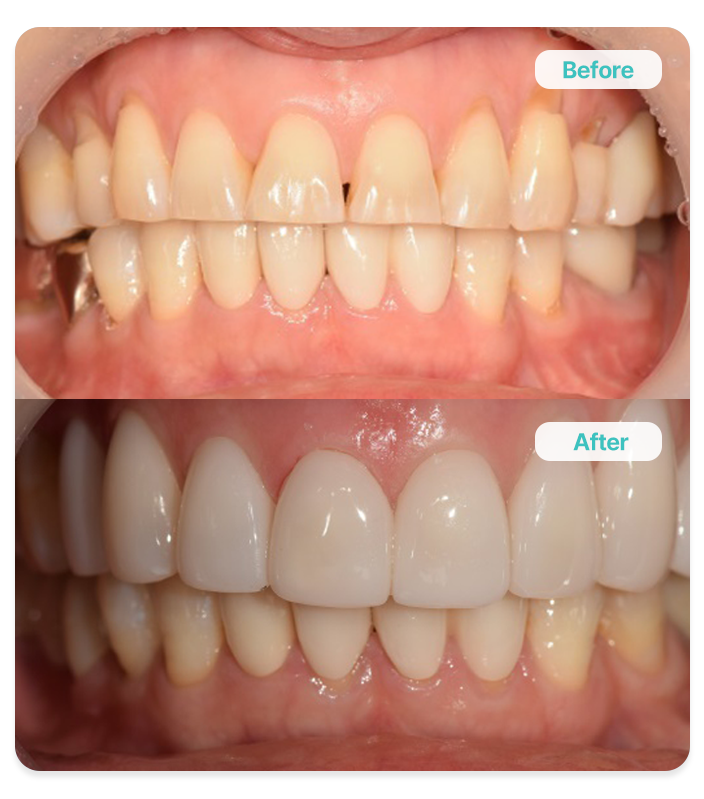 연예인 비앙쉬 48세<br><br>