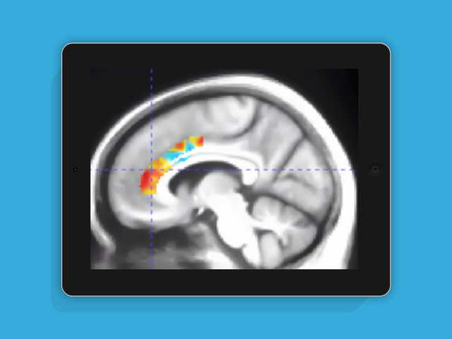 Effects of Computerized Cognitive Training on Vesicular Acetylcholine Transporter Levels