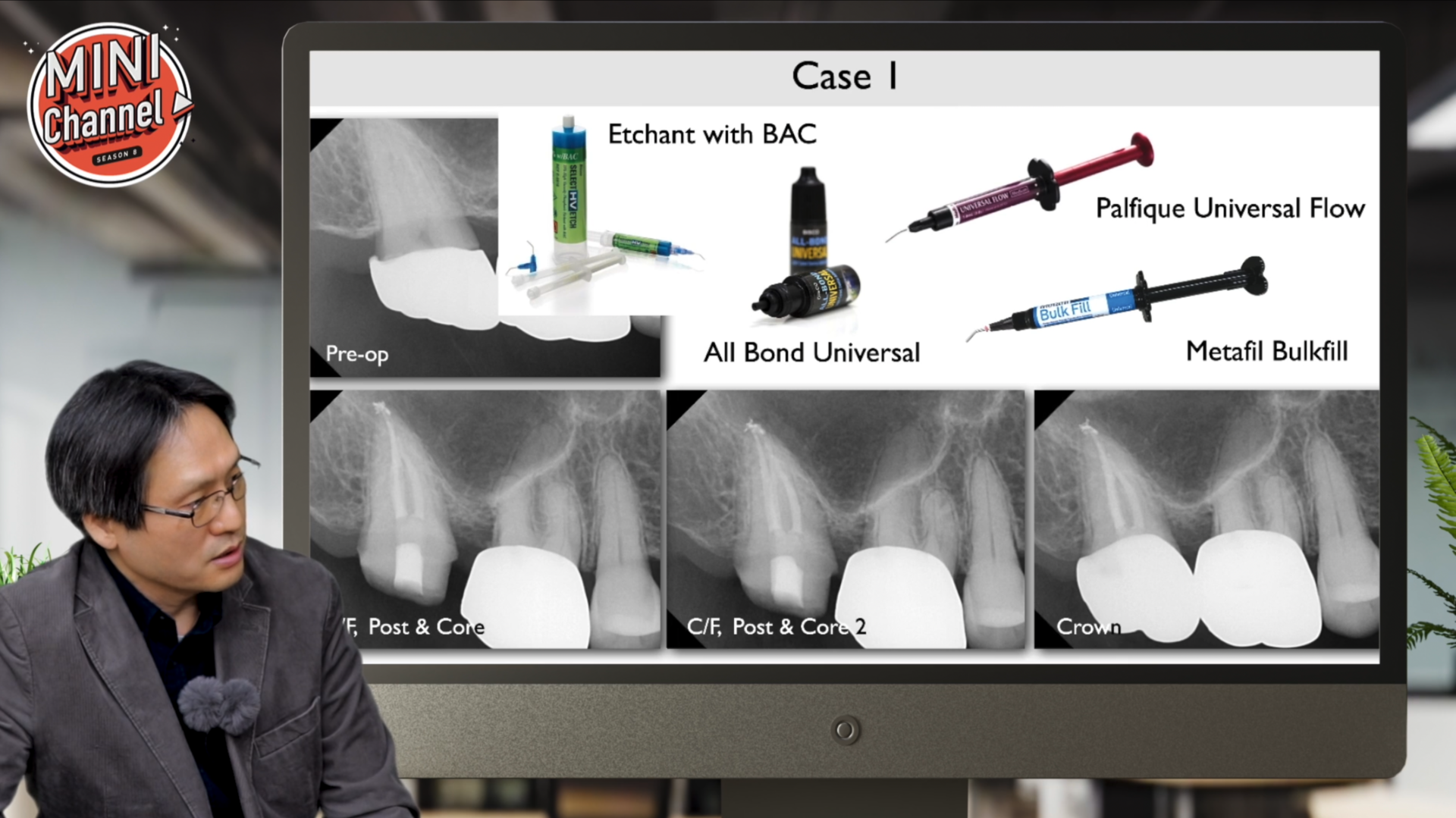 근관 치료 재료·기구·장비 공유 썸네일