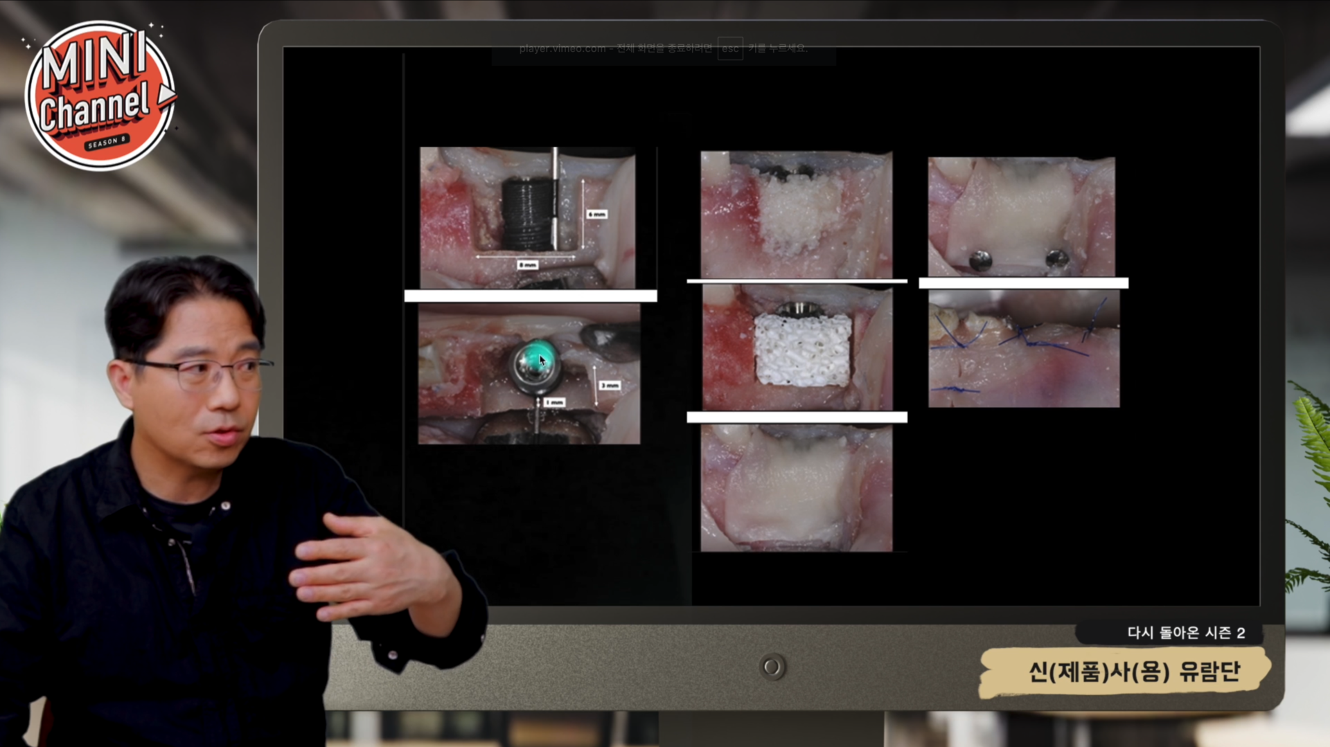 Pin 신제품 사용 유람단 썸네일