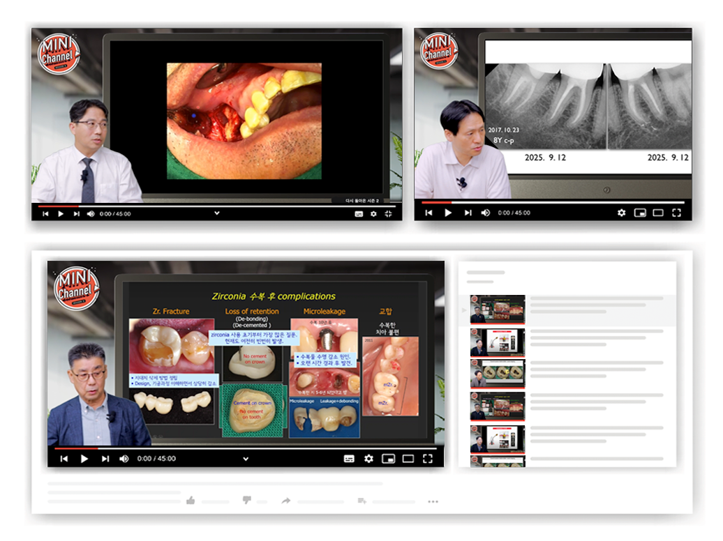 에듀덴트 온라인 강의 관련 이미지(예시)