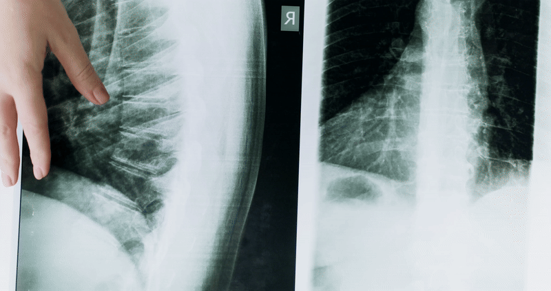 잇피 | 근골격계 건강을 위한 맞춤형 관리 솔루션 제공, 디지털 헬스케어 링닥이 함께 합니다.