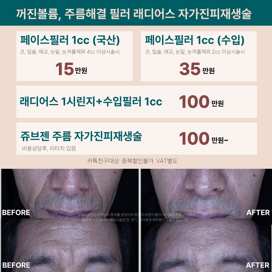 필러, 래디어스, 쥬브젠 자가진피재생술 특별이벤트 원주피부과 원더스의원!