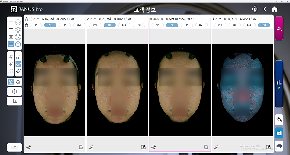 <SMALL>블룸새살침 4회 | 모공 컨택터 2회 | 트러블 컨택터 2회</SMALL>