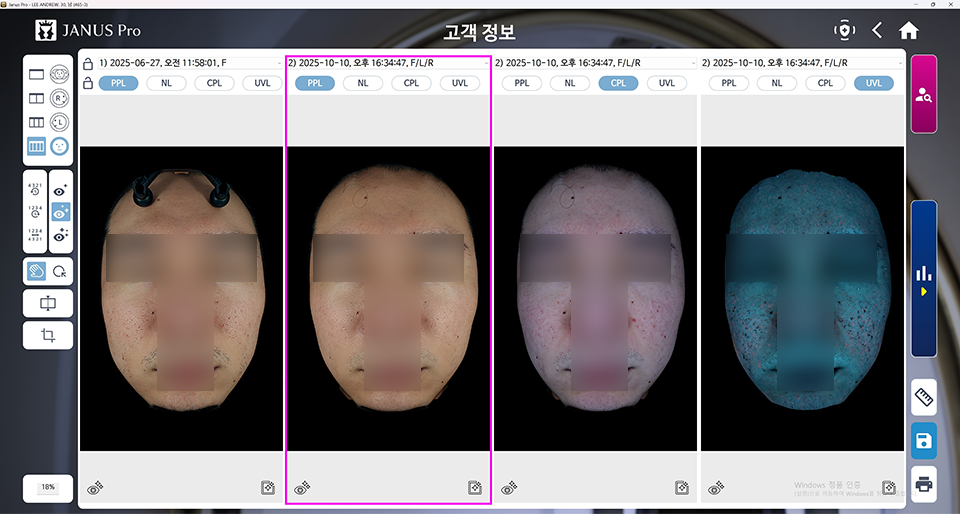 <SMALL>블룸새살침 4회 | 캐비어 리빌더 4회</SMALL>