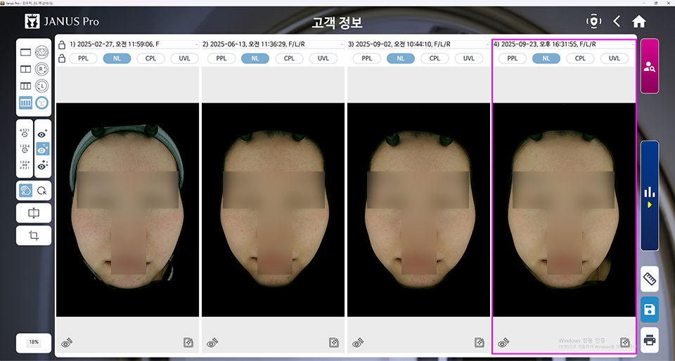 <small>모공 컨택터 10회</small>