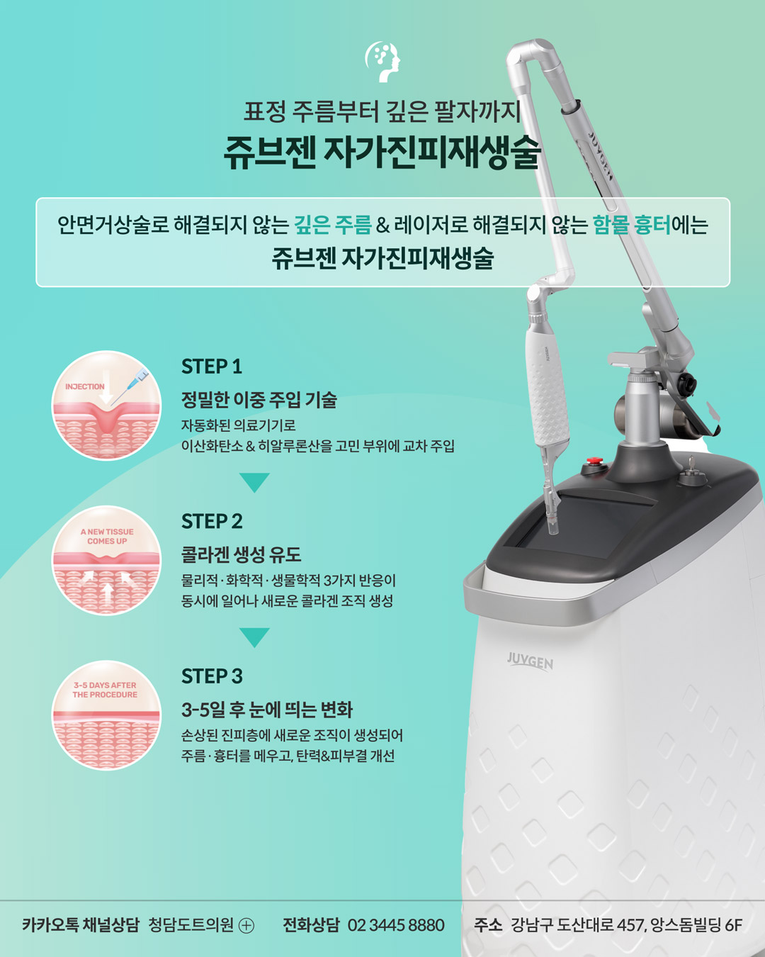 쥬브젠 자가진피 재생술 안내