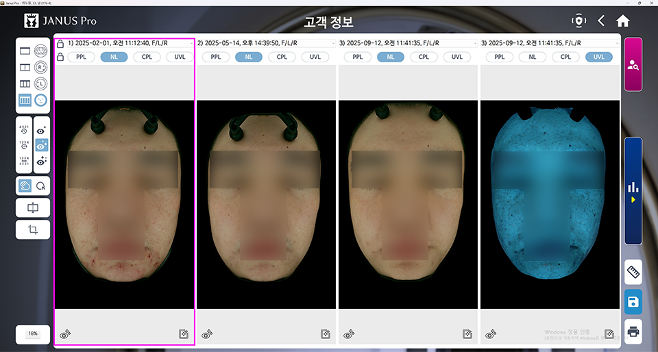 <SMALL>블룸새살침 5회 | 트러블 컨택터 10회</SMALL>