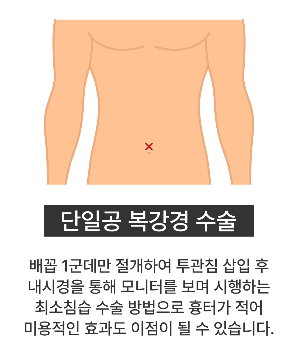 단일공 복강경 수술