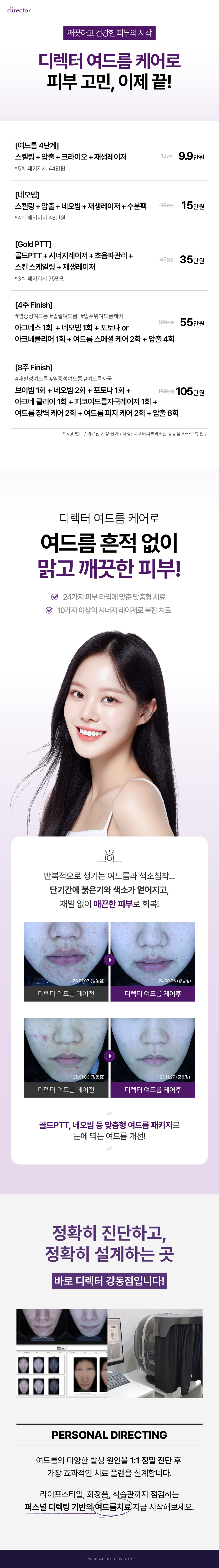 강동 디렉터 여드름 케어, 여드름, 색소침착, 트러블 없이 맑고 깨끗한 피부