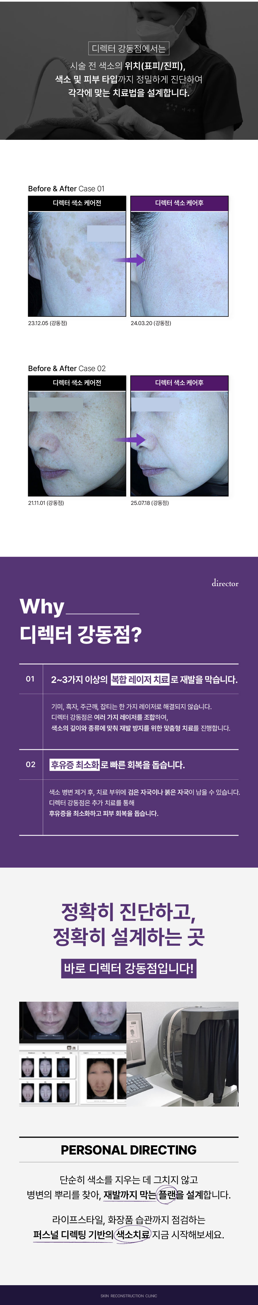 색소올킬 이벤트, 색소 침착, 색소 토닝, 듀얼 토닝, 기미 부스터 