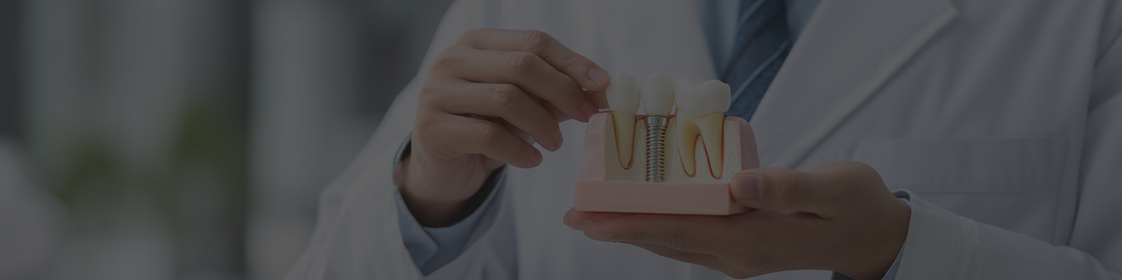 <h4 style="text-align: center;"> <strong> <span style="color: rgb(255, 255, 255);">원데이 임플란트</span> </strong> </h4><br> <br>    <span style="color: rgb(108 147 155);">–––––––</span>  <br> <h6 style="text-align: center;">  <span style="color: rgb(255, 255, 255);">원데이 임플란트란?</span> <br> <br>   <span style="color: rgb(255, 255, 255);"> 원데이 임플란트는 발치와 임플란트 식립을 같은 날 진행하는 방식으로,  <br>내원 횟수를 줄이고 치료 흐름을 간편하게 관리할 수 있는 방법입니다. <br>발치 직후 잇몸 형태가 유지되는 시기라 앞니처럼 심미적인 부위에서도   <br>자연스러운 결과를 기대하기에 적합한 구조를 갖고 있습니다.</span>   </h6>