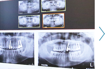  <span><br></span> <h6 style="text-align: center;"> <span style="background-color: #4999b7;     border-radius: 50px;     color: white;     padding: 0 8px;     font-size: 0.8em;">STEP 02</span></h6> <span><br></span> <h6 style="text-align: center;"><span style="color: fff;">디지털 기술로<br>정밀 진단 합니다</span>   </h6>