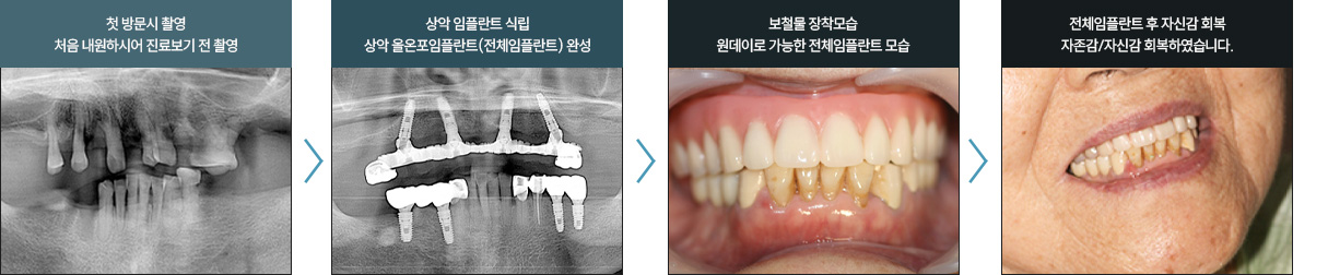 처음 내원하시어 진료보기전 촬영